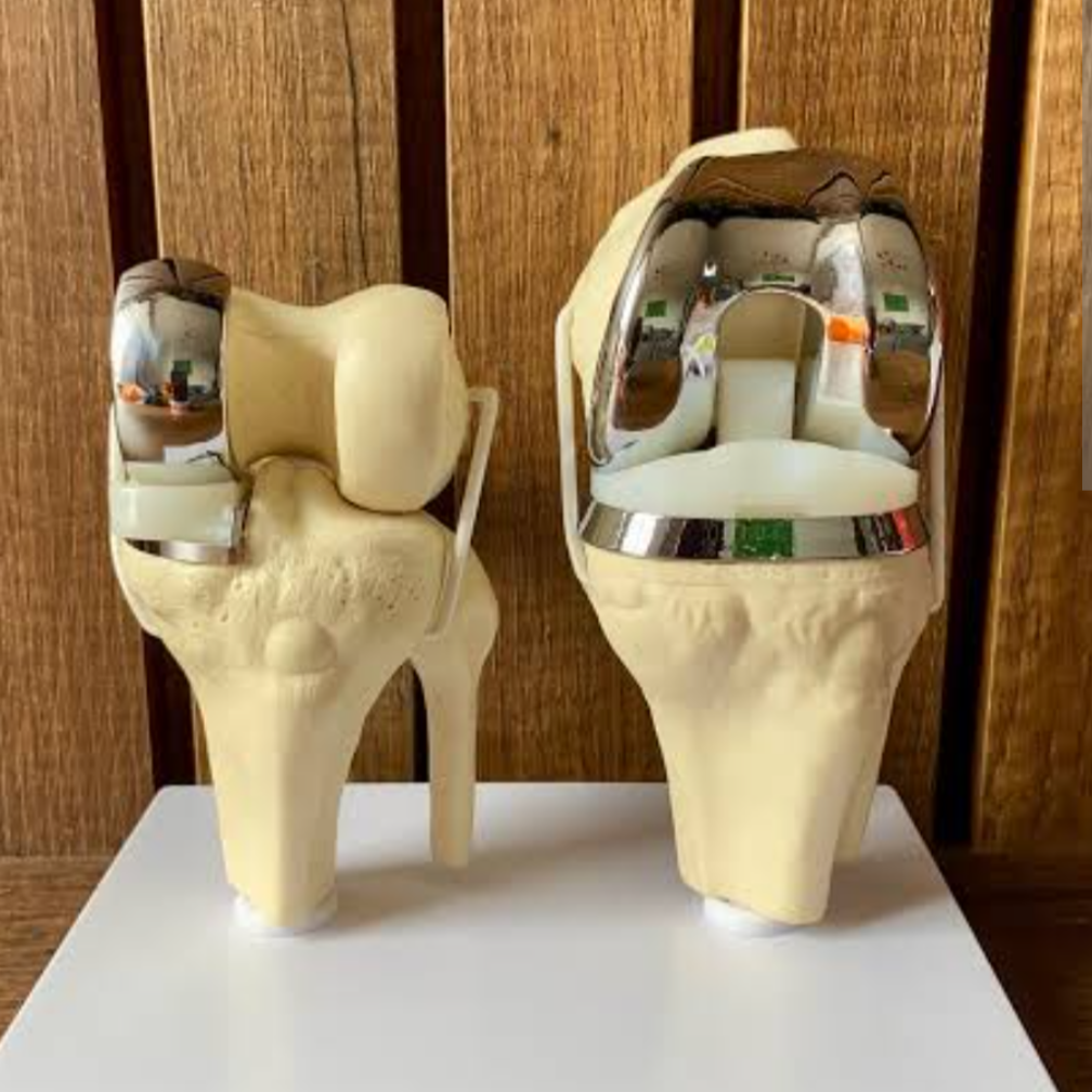 Modelos de prótesis de rodilla